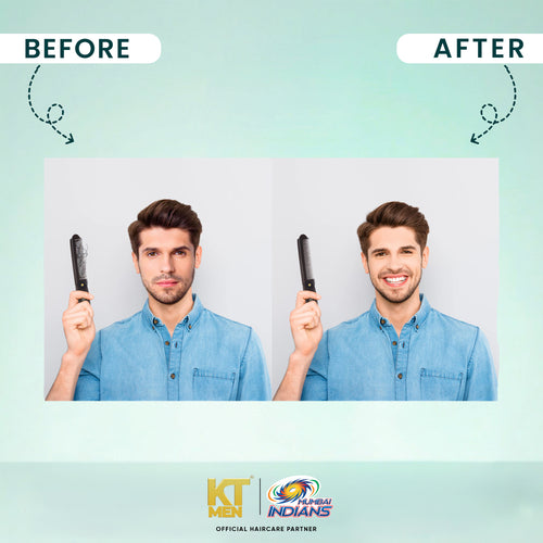 Root Force Anti Hairfall Conditioning Shampoo - 200 ml (Mumbai Indians)