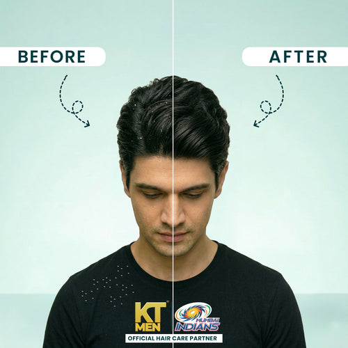 Anti-Dandruff Lock Control Conditioning Shampoo - 200 ml (Mumbai Indians)